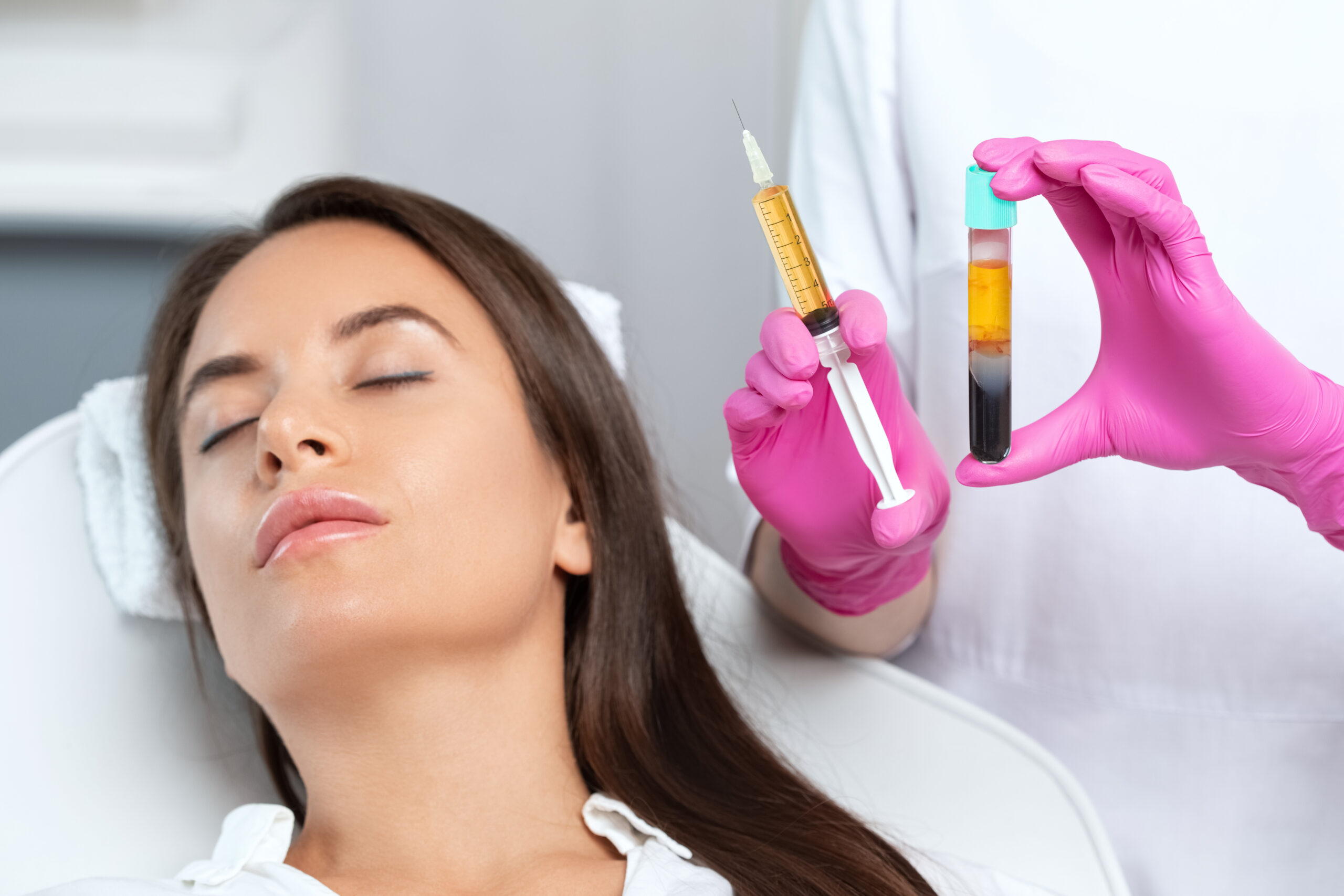 PRP Treatment